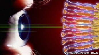 科学家成功打印视网膜细胞 或治愈失明