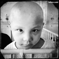 被忽视的儿童癌症