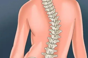 从3方面判断是否脊椎侧弯 主要有三大危害