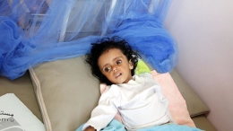 也门面临大范围饥荒