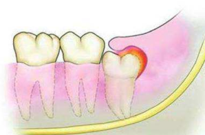 牙齿的花式疼痛你说得清吗？主要有这四种