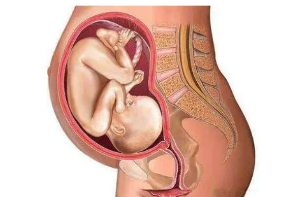 孕晚期怎样预防早产？要做好6大预防措施