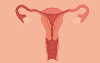 子宫脱垂有哪些症状？子宫脱垂患者应如何护理