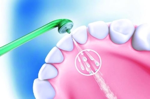 洗牙并不等同于牙齿美白  定期洗牙很重要
