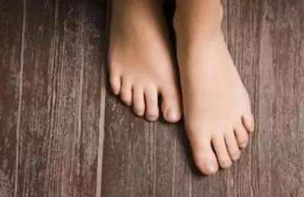双脚经常出现这四种异常 要警惕是高血脂