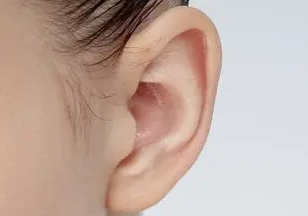 耳廓畸形“扯一扯就好”？别错过矫正“黄金期”