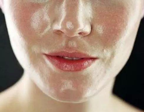 如何能控制好自己脸上的油？油性皮肤怎么护理