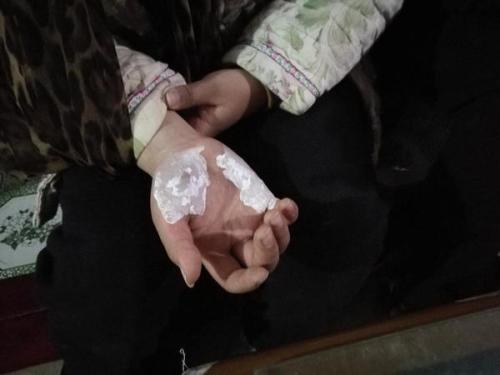 　　为他的勇敢点赞
