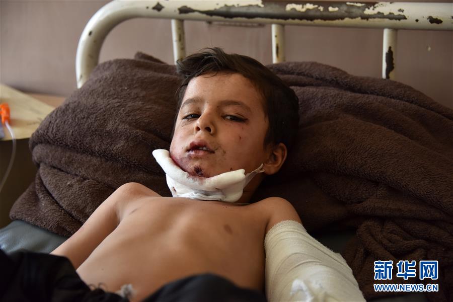 8月13日，在阿富汗坎大哈省，一名在炸弹袭击中受伤的儿童在医院接受治疗。 新华社发（萨纳乌拉·西奥姆摄）
