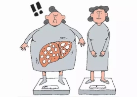 中老年人才会患脂肪肝？对脂肪肝八大误解