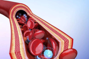 血管里有垃圾吗？医生说的血管堵塞是什么