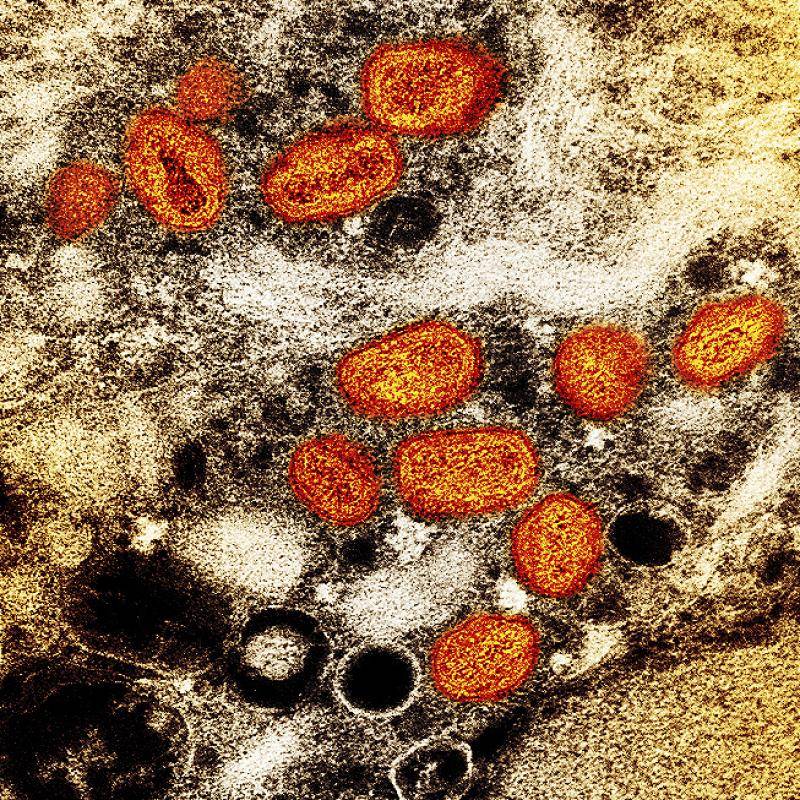 世界卫生组织：猴痘病毒正在人际传播 切勿污名化