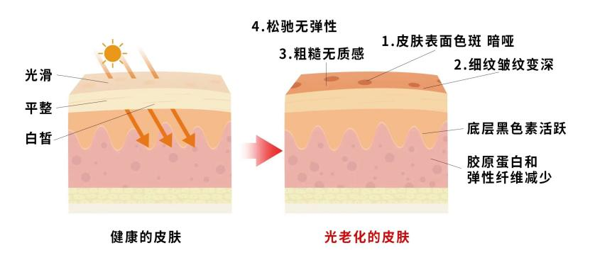 健康日历 为什么说美白尽头是抗光老