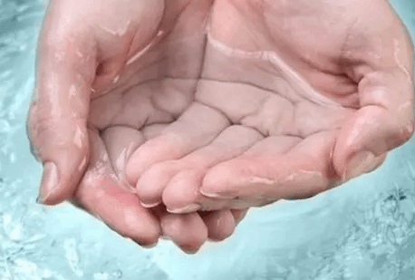 手指泡水后为什么变皱？科学家终于有答案了