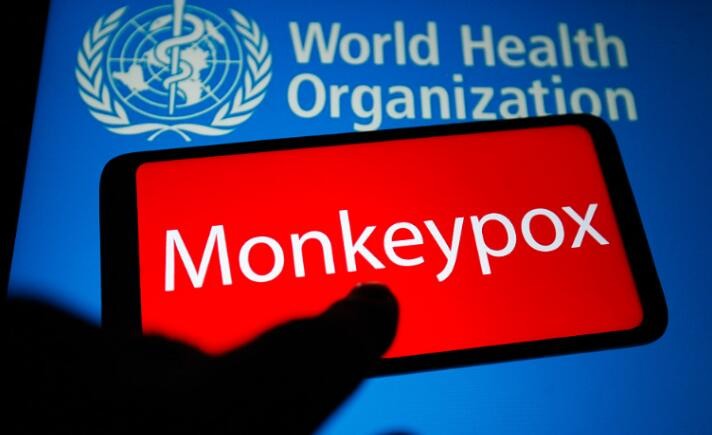 俄研发猴痘病毒检测盒 已完成实验室测试