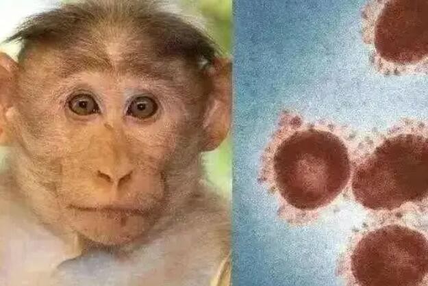 美国疑现首例猴痘死亡病例