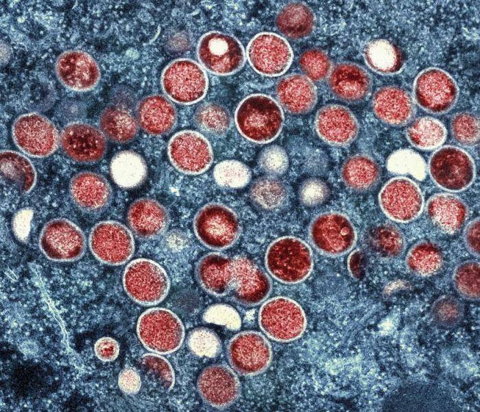泰国猴痘感染病例达559例 其中2例死亡