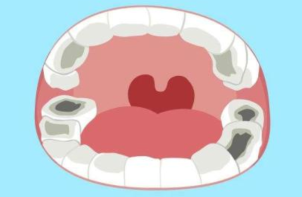 牙痛主要有这五中原因 平时该如何清洁牙齿