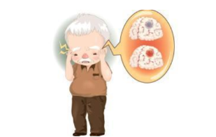 该如何预防卒中？要记牢这些生活方式秘籍
