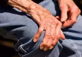 帕金森病是如何引起的？有这四大临床表现