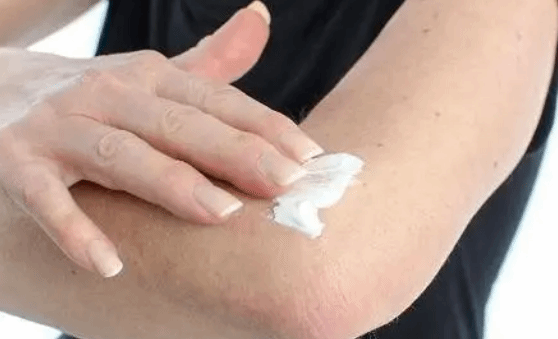 冬季积极防治荨麻疹？做好3点就能控制病情