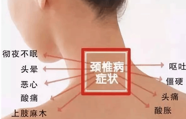 寒冷空气一刺激 颈椎病又犯了?冬季如何预防颈椎病