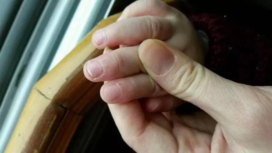 家长要注意小儿出现这6种异常 提示该补锌了