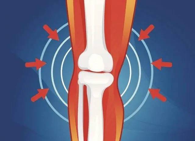 为啥人老先老腿？知道这五个真相 且行且珍膝