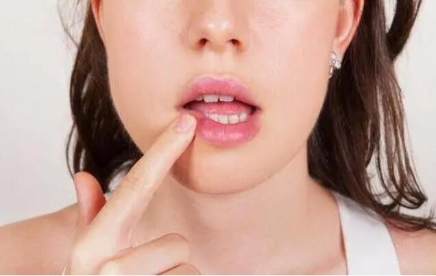 口腔黏膜有2大功能？教你如何养护