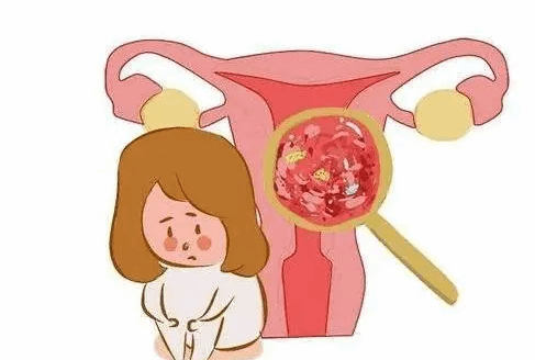 子宫肌瘤有这么多种类型 宫腔镜都能检查出来吗