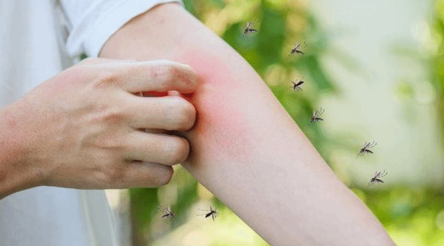 被蚊虫叮咬后皮肤感染怎么办？及时处理可缓解不适