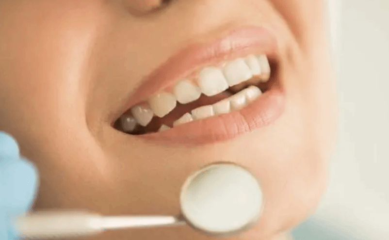 备孕应进行口腔检查及时消除牙病 孕期少麻烦