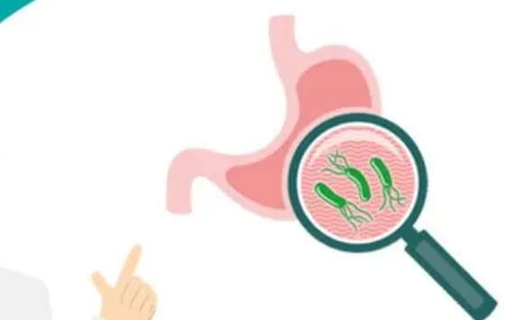 怎么检查幽门螺杆菌？哪些人需要根除Hp