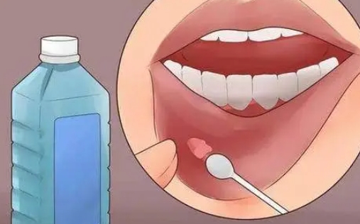 老是上火怎么办？4种症状长期不愈别硬扛