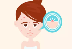 如何预防皮肤长痘？这4大原因导致经常长痘