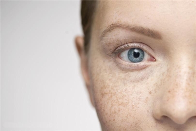 女人最怕脸上长斑点？别慌教你6招远离斑点