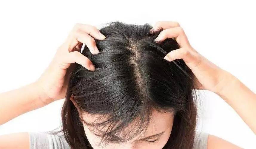 脱发并不简单 根据病因可分为这5种类型