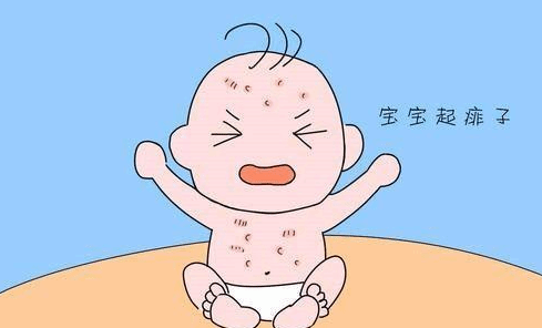 宝宝夏季容易长痱子？父母要做好这5件事