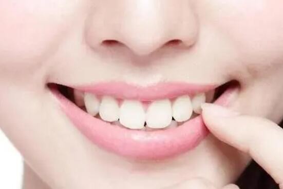 牙渍、牙垢、牙菌斑、牙结石 你区分清楚吗