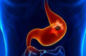 吃这7种食物可以养胃 胃病患者有啥注意事项