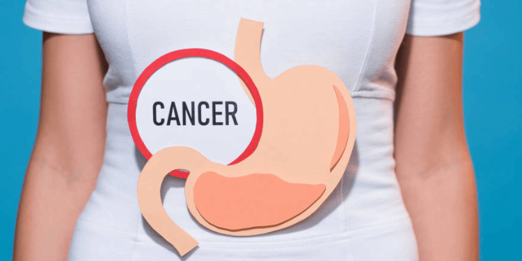 多数癌症是吃出来的？这5种易致癌食物要少吃