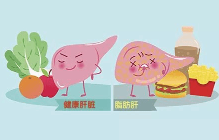 不是胖人才会得脂肪肝吗？瘦人也会得脂肪肝