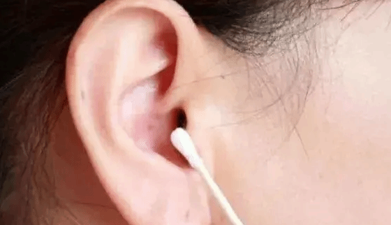 女子用棉签掏耳朵险丧命 还有人引发了癫痫