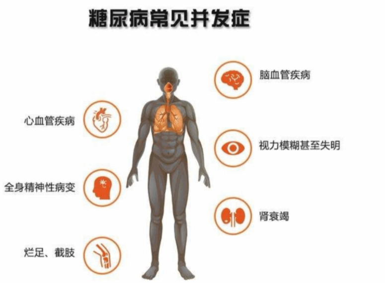 糖尿病常见的4大并发症 看了后不可不防