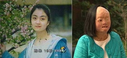 自焚事件留下无比的痛
